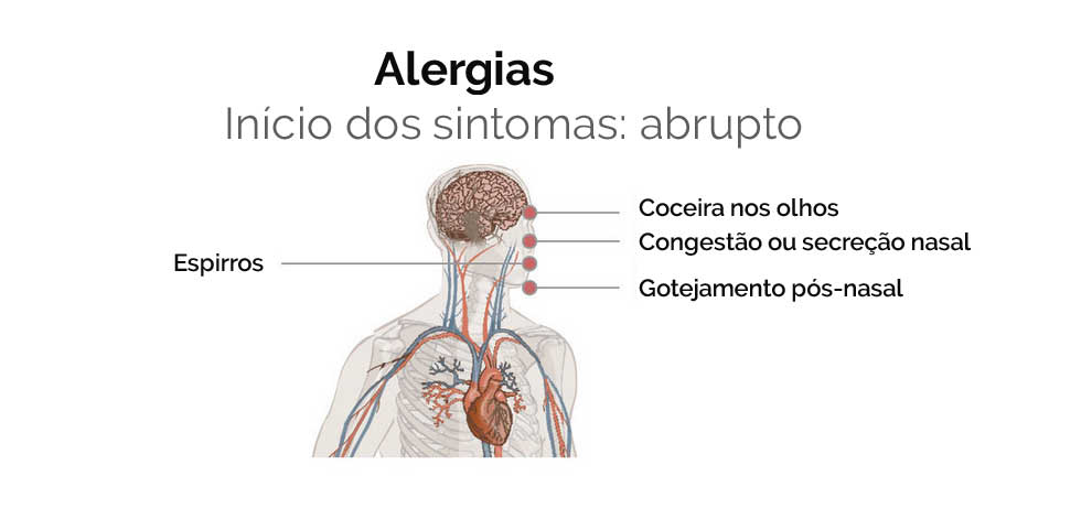 Sintomas de alergias