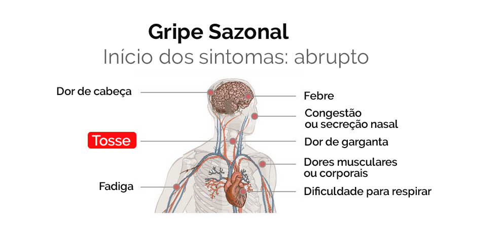 Sintomas de gripe sazonal