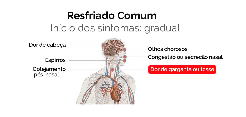 Sintomas de resfriado comum